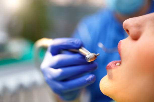 Dental Bonding in Gary, IN